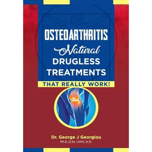 Osteoarthritis: Natural Drugless Treatments That Really Work!